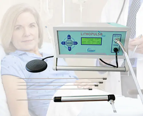 Pneumatic Lithotripter System, Aymed